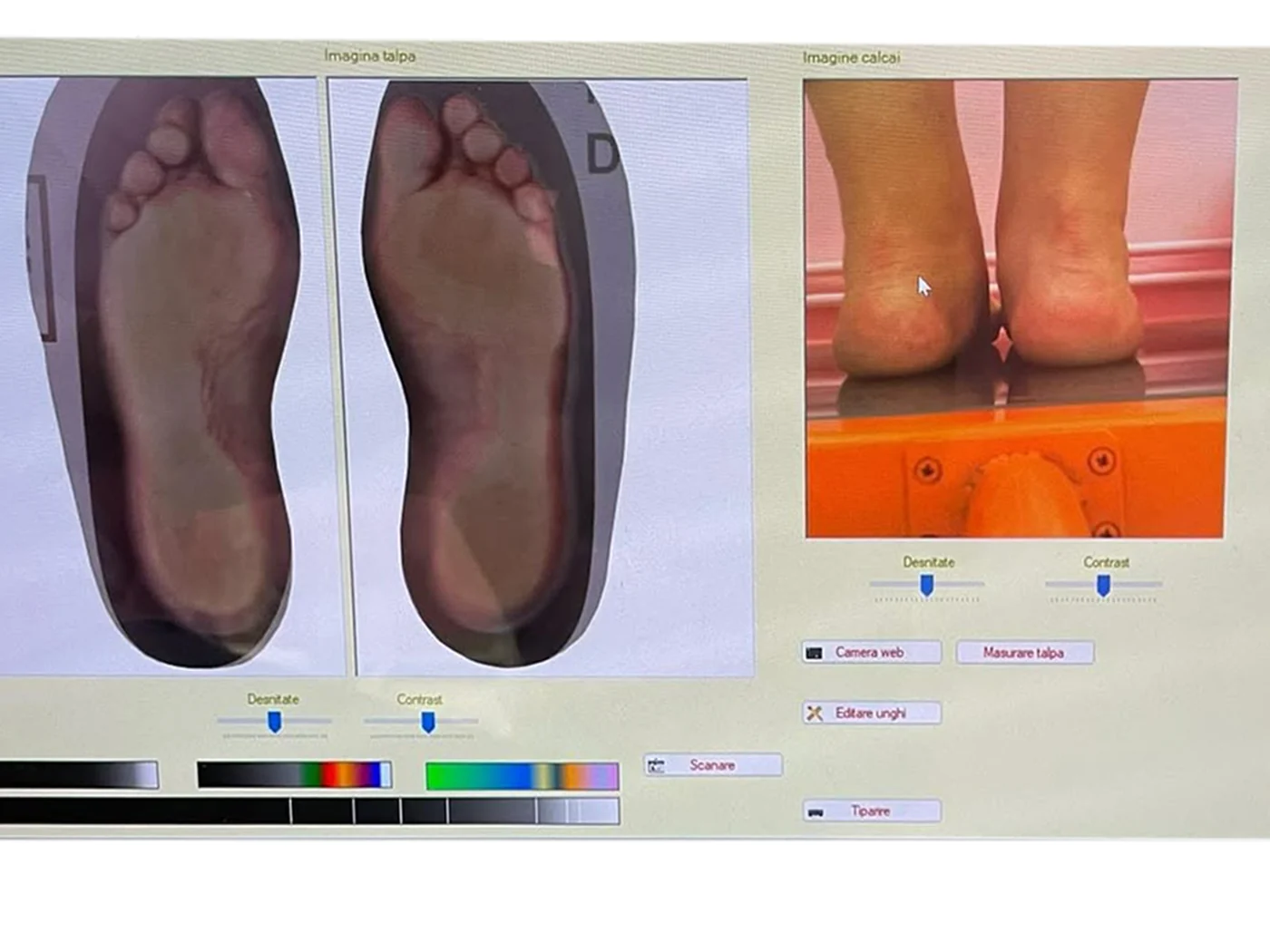 Scanarea plantară
